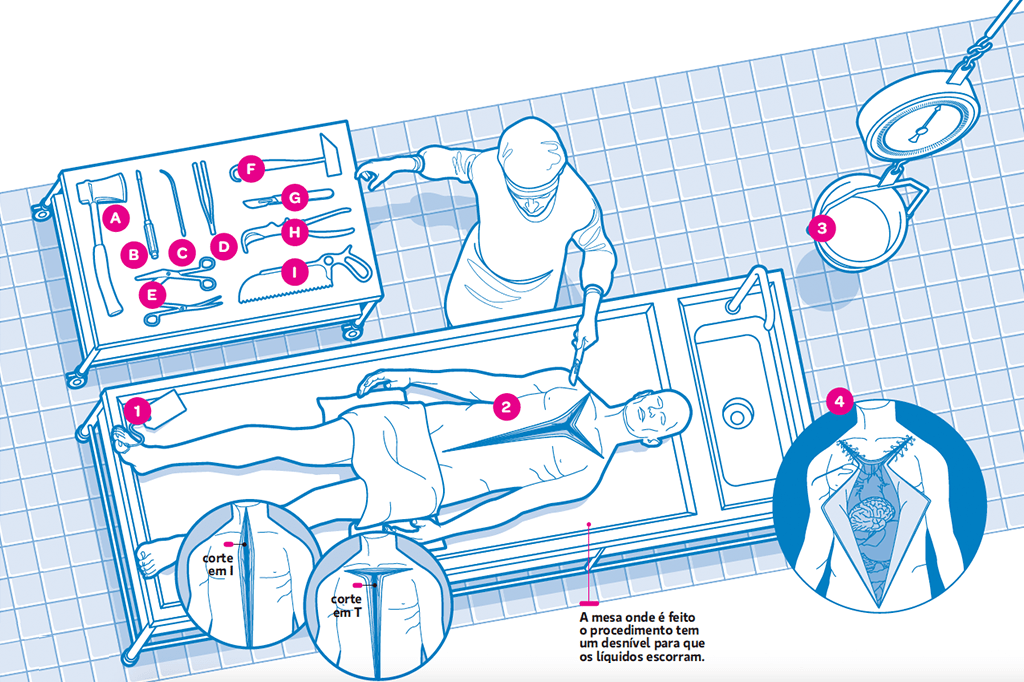 Como funciona a necropsia