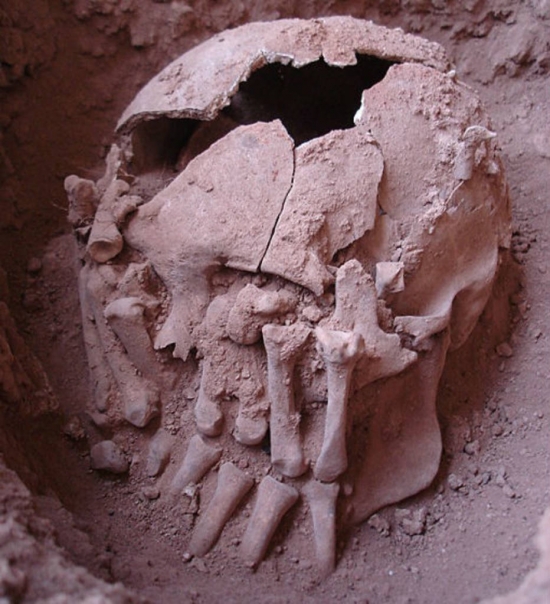 cranio