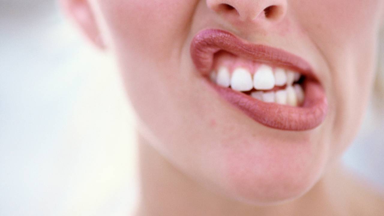 Dentes