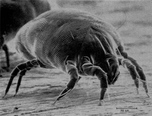 Eles estão presentes em toda residência e podem causar alergias. Os ácaros medem entre 0,2 e 0,5 mm e comem escamas de pele humana.