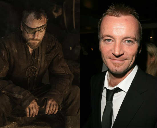 Richard Dormer, quando se transforma em Beric Dondarrion, ganha muito mais do que um tapa-olho: leva de brinde algumas cicatrizes que o tornam quase irreconhecível Richard Dormer, quando se transforma em Beric Dondarrion, ganha muito mais do que um tapa-olho: leva de brinde algumas cicatrizes que o tornam quase irreconhecível