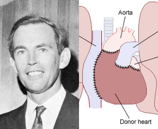 TRANSPLANTE DE CORAÇÃO (1967) - O primeiro transplante de coração humano foi feito pelo médico sul-africano Christiaan Barnard.