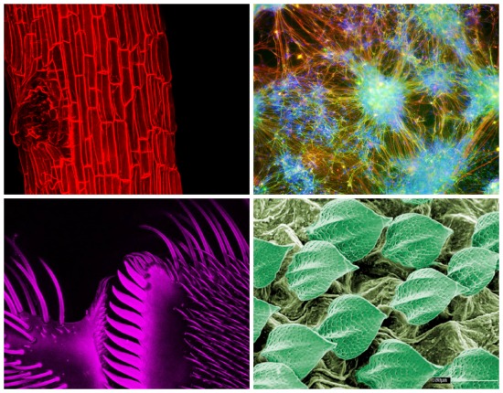 A microscopia rende imagens incríveis. E dá até prêmio. Veja os vencedores do Concurso de Imagens de Microscopia em Ciências da Vida, promovido pelo Instituto de Ciências Biomédicas da USP em parceria com a ZEISS.