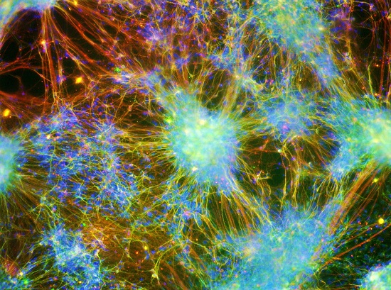 Conexão. Não há nome melhor para uma foto que mostra uma rede de neurônios humanos conectados. A imagem é de Alexandre Teixeira Vessoni