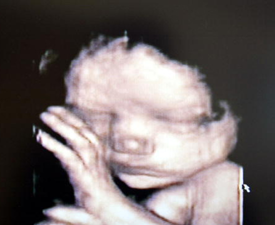 SEQUENCIAMENTO GENÉTICO DE FETOS - Em junho de 2012, cientistas da Universidade de Washington em Seattle, conseguiram fazer o sequenciamento genético de um feto, usando apenas partículas de DNA suspensas no líquido amniótico. Desta forma, não foi preciso realizar uma ação intrusiva no feto.