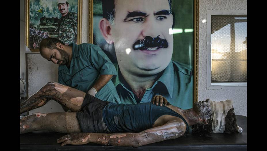 Esta foto do brasileiro Mauricio Lima para o <em>New York Times</em> mostra um médico aplicando pomada nas queimaduras de Jacob, um guerrilheiro do Estado Islâmico de apenas 16 anos. Ao fundo, um pôster de Abdullah Ocalan, líder curdo que está preso na Síria. Mauricio ganhou o primeiro prêmio na categoria Notícias Gerais.