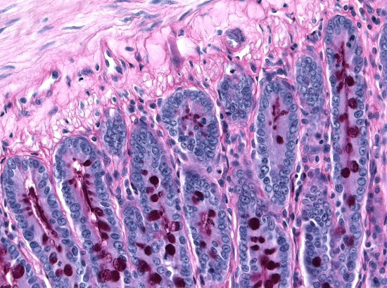 O segundo lugar ficou com esta imagem, que mostra o glicogênio no intestino delgado de ratos.O autor é o pesquisador Marcos Vinícius Mendes Silva.