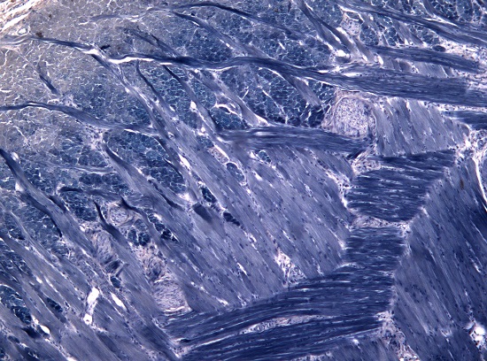 A imagem mostra um corte de língua corado com a substância hematoxilina fosfotúngstica. O nome da foto? Língua num mar azul, de Gisela Ramos Terçarioli.