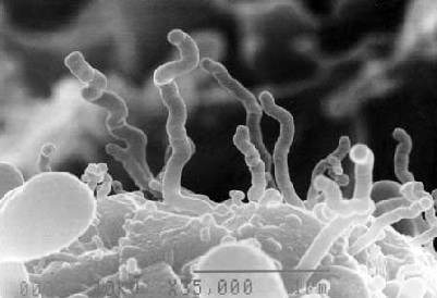 Descobertos em 1996, no fundo do mar, os nanobes foram descritos como uma das menores formas de vida conhecidas. Eles têm entre 20 e 150 nanômetros, quase tão pequenos quanto um vírus.