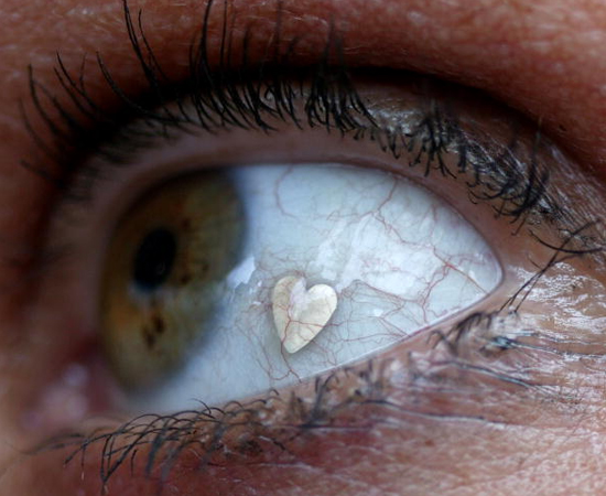 OCULOFILIA - Sentir excitação ao lamber o globo ocular de outra pessoa, ou ter seus olhos lambidos por alguém.
