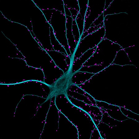 O hipocampo é uma parte do cérebro considerada fundamental para a memória. Em quinto lugar, essa imagem mostra um neurônio do hipocampo em atividade. O hipocampo é uma parte do cérebro considerada fundamental para a memória. Em quinto lugar, essa imagem mostra um neurônio do hipocampo em atividade.