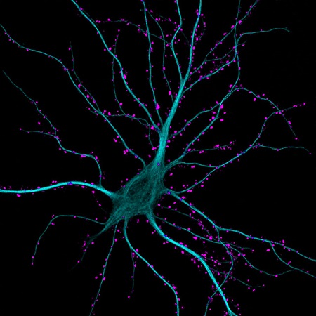 O hipocampo é uma parte do cérebro considerada fundamental para a memória. Em quinto lugar, essa imagem mostra um neurônio do hipocampo em atividade.