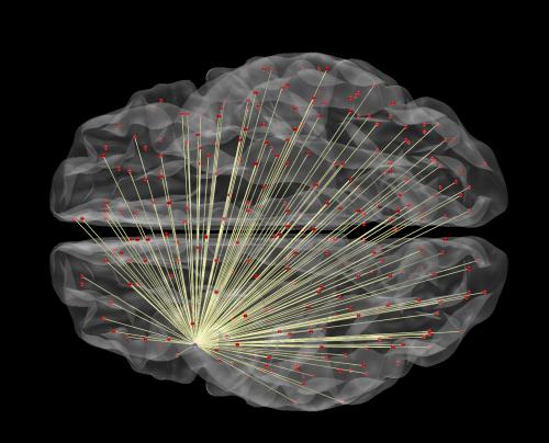 2-brainimaging