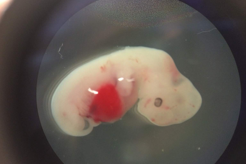 Os híbridos de porcos e humanos não são tão promissores – ainda