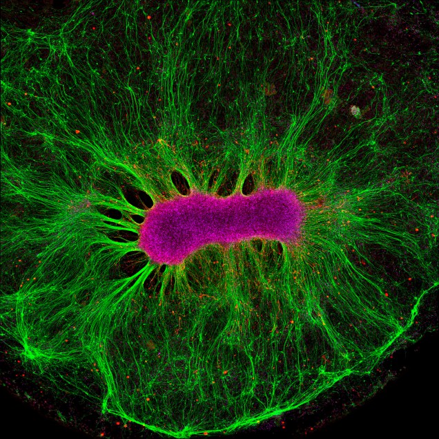 Células-tronco cerebrais têm o poder de virar quaisquer tipos de células existentes no sistema nervoso. A imagem dá uma ideia desse poder. As células são esse punhado rosa no meio, enquanto o que você vê em verde são fibras que elas criaram. Tudo isso em apenas duas semanas. Essa foto, em específico, ainda tem um bônus: faz parte do projeto <em>Human on a Chip</em>, que é contra testes de medicamentos em animais. Eles tentam recriar órgãos (ou parte deles) em laboratório, para que os experimentos não machuquem um ser completo, mas apenas um punhado de células.
