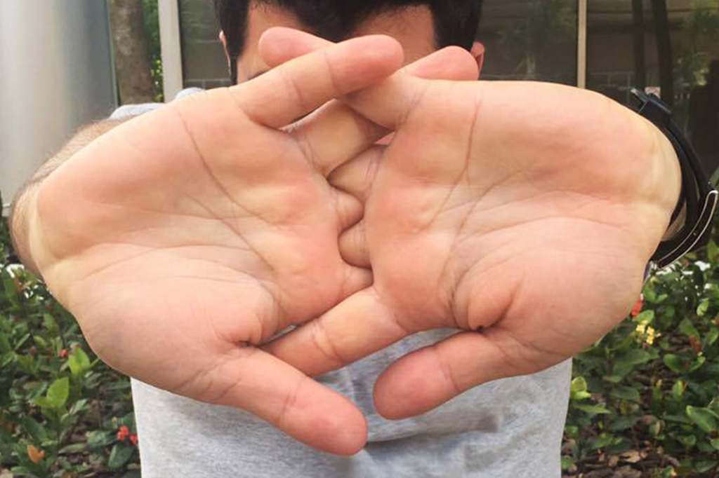 Close up de um pernilongo picando o dedo de uma pessoa.