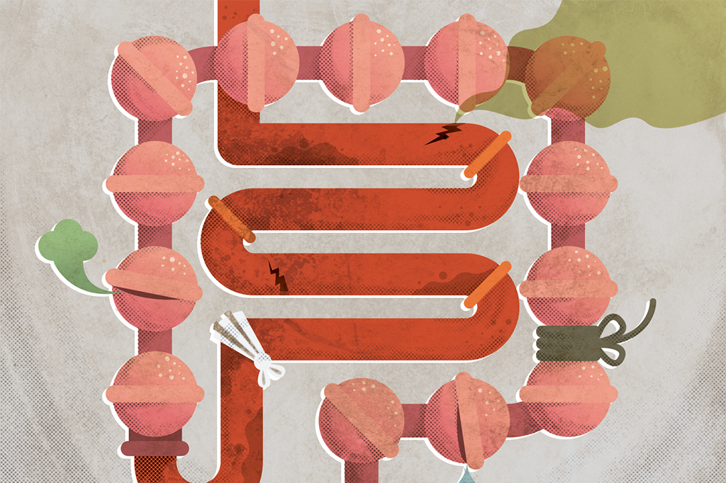 Teu passado te condena (à obesidade)