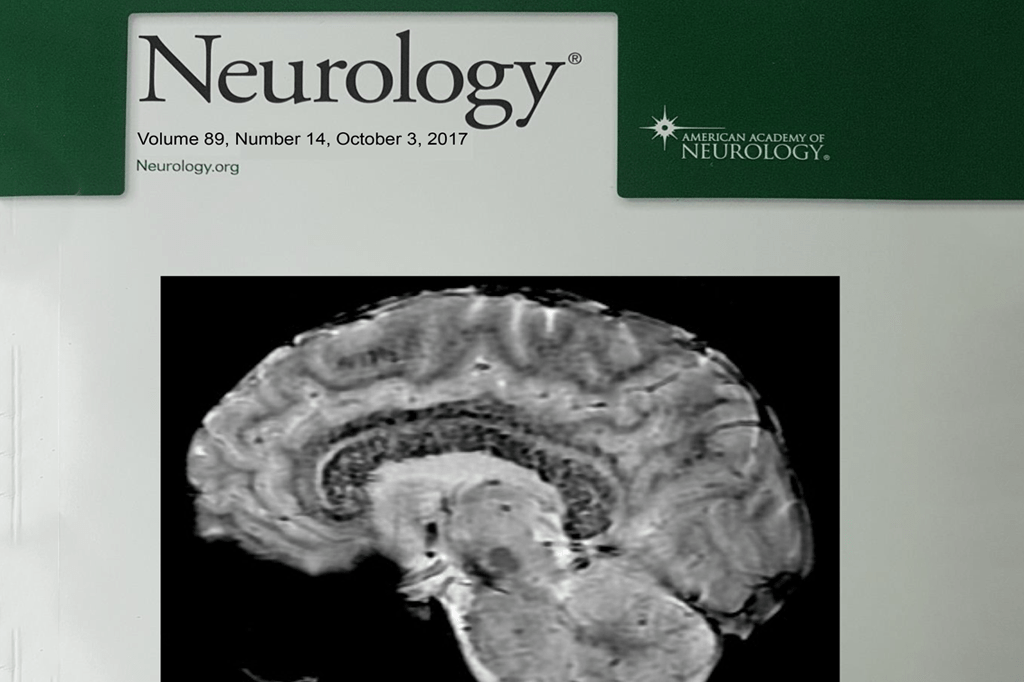 Brasileiros “fotografam” efeitos da altitude no cérebro e viram capa de revista científica