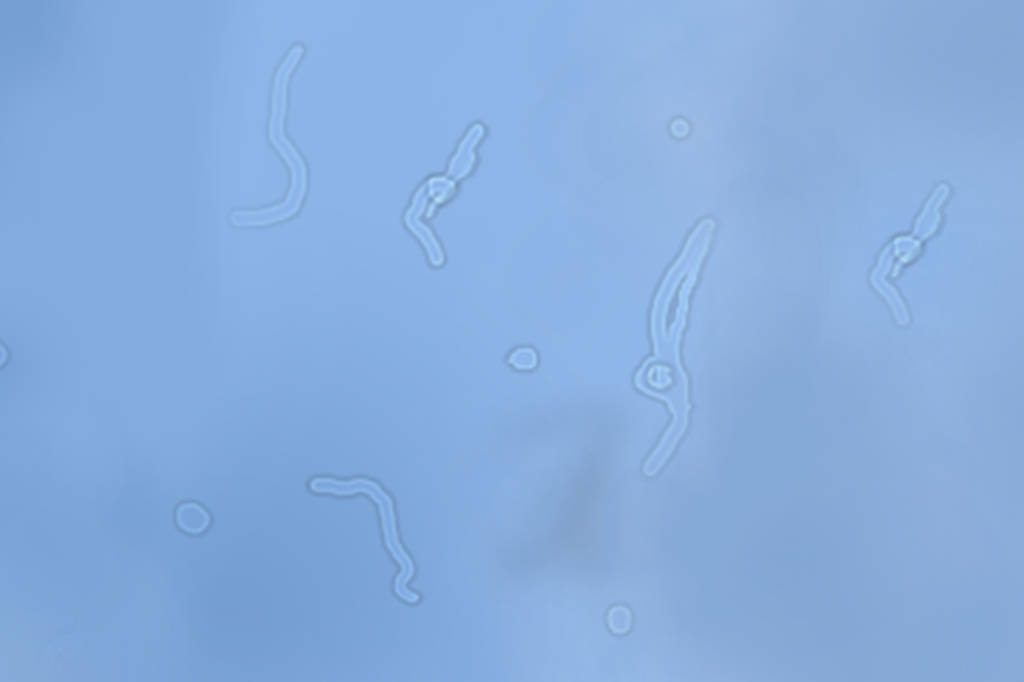 Por que às vezes enxergamos vermes transparentes?