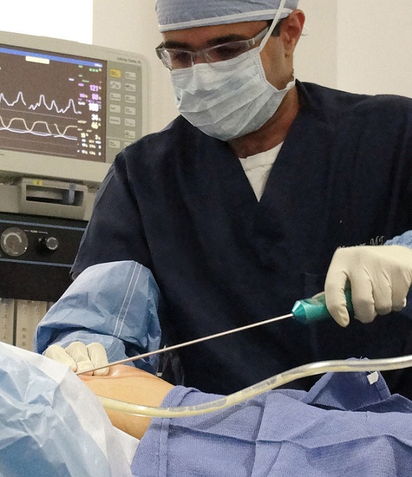 663px-Dr_Vishal_Kapoor_Performing_Liposuction_Surgery_01