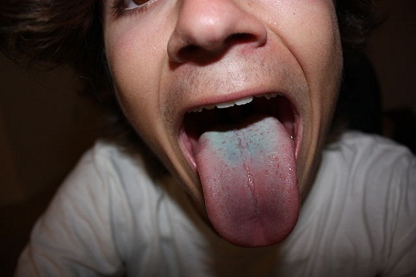 Tongue_(2525939653)