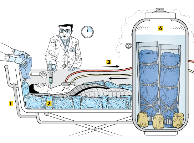 Existem mesmo pessoas congeladas para ressuscitar no futuro?