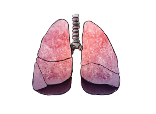 pulmão inchado