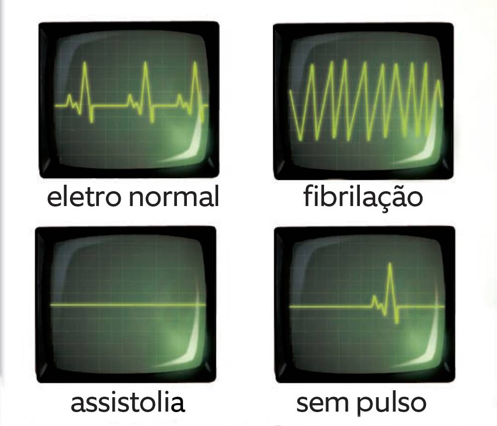 Como é ressuscitada uma vítima de parada cardíaca?