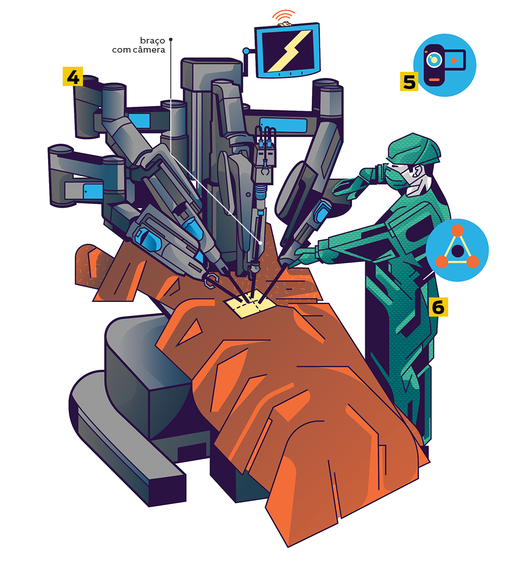 Cirurgia-Robô-2