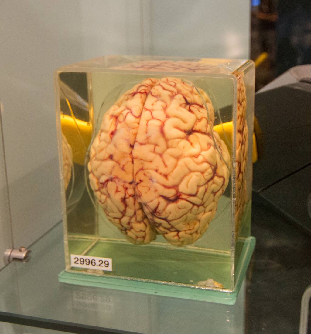 human_brain_preserved_in_formaldehyde