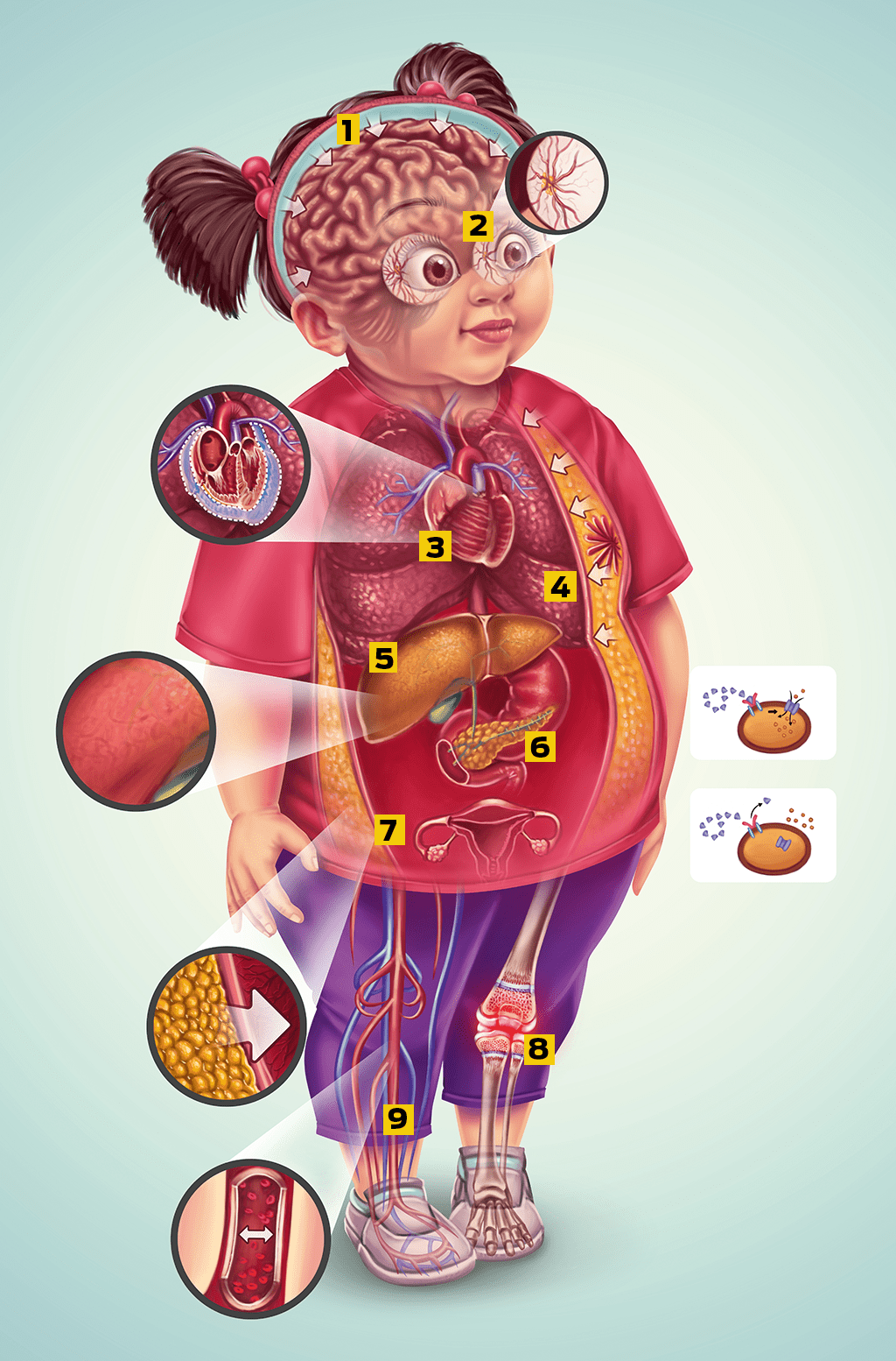 Obesidade-1