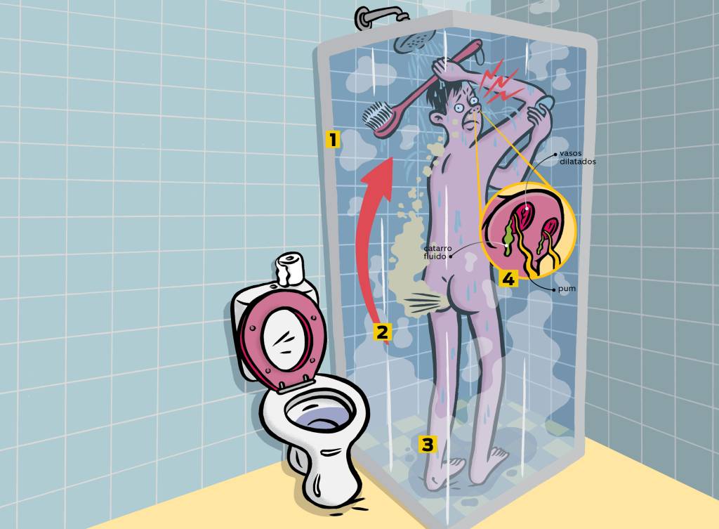 Por Que O Peido Parece Mais Fedido Durante O Banho Super