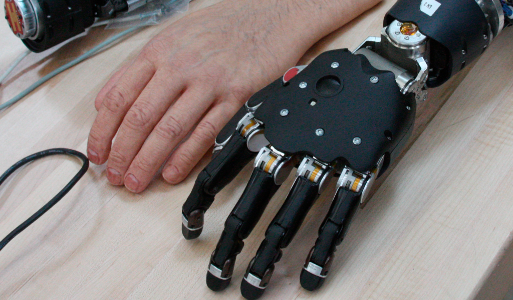 Como uma prótese é instalada?