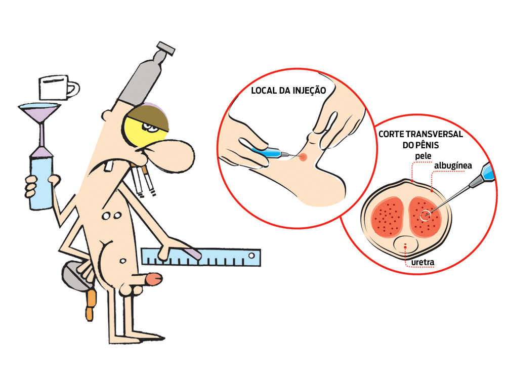 Existe cirurgia para aumentar o tamanho do pênis?