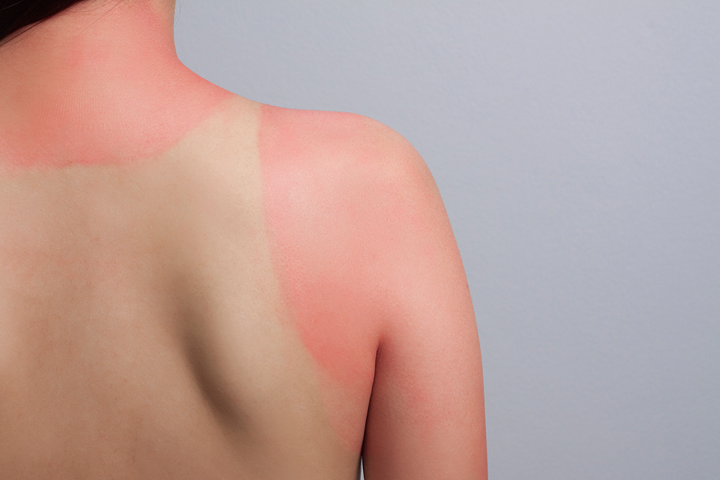 Pulserinha de papel avisa quando você passou tempo demais no Sol