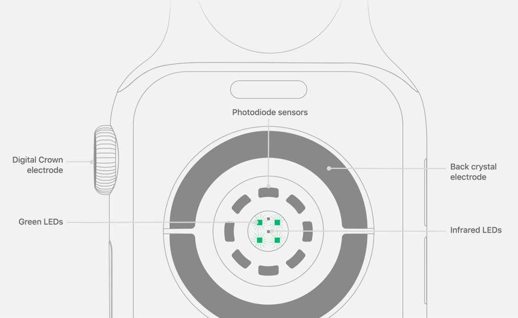 apple-watch-eletrocardiograma-2 Saúde high-tech: exames que podem ser feitos pelo celular ou smartwatch