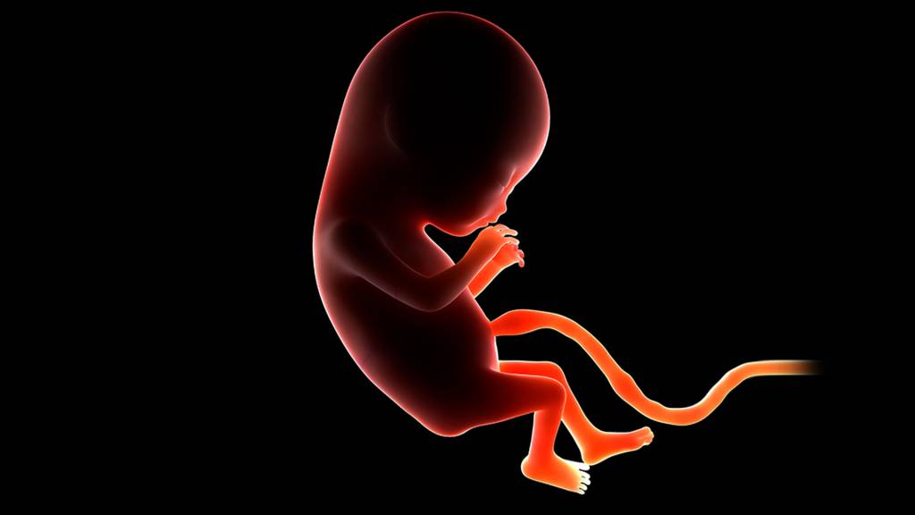 Bebê colombiana nasce com irmã gêmea dentro do abdômen