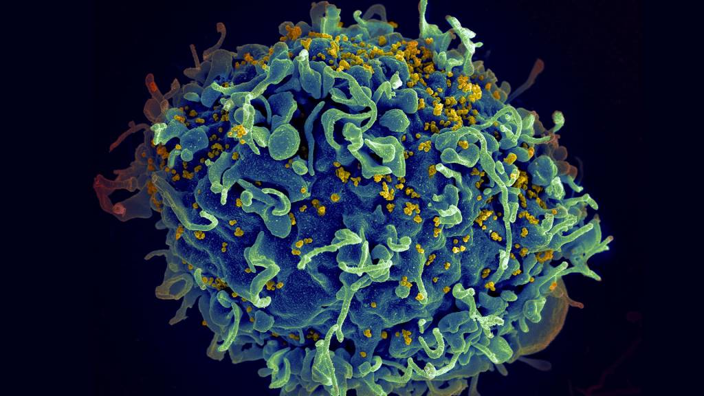 Como funciona a técnica que permitiu a segunda cura do vírus HIV na história