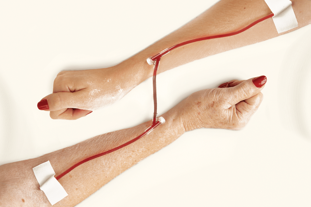 Sangue Novo: os tratamentos que filtram o sangue e prometem frear o envelhecimento
