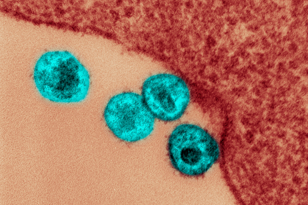 Cientistas eliminaram o HIV de animais vivos pela 1ª vez. O que isso significa?