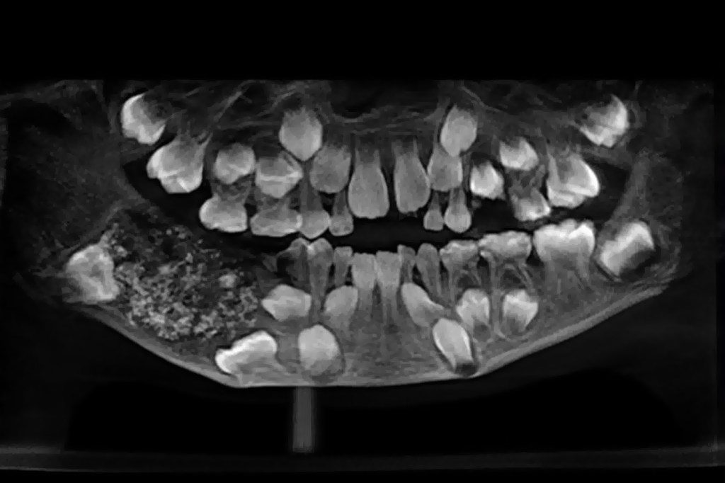 dentes01 dentes01