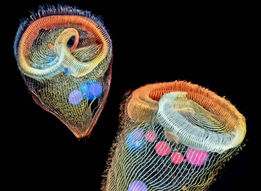 <span style="font-weight:400;">A medalha de prata vai para uma imagem composta por protozoários unicelulares de água doce. Além da observação das organelas dentro de seu corpo, o destaque vai pra captura de detalhes: os cílios, usados por eles para alimentação e locomoção, receberam um brilho especial.</span>
