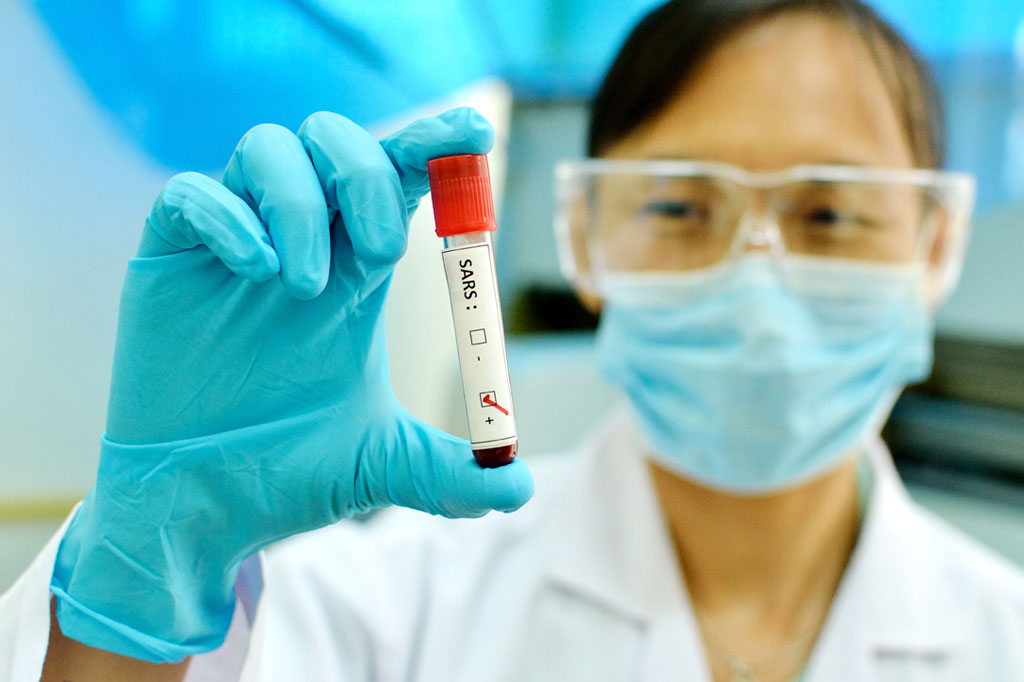 Material genético do novo coronavírus é 80% igual ao do vírus da SARS