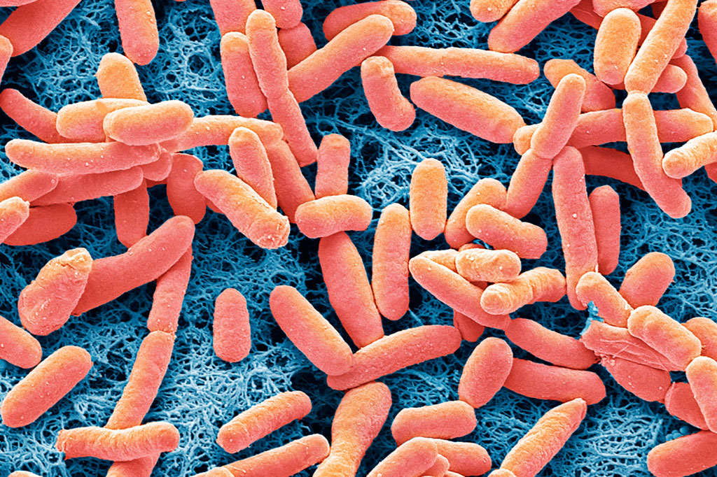 Bactérias tornam-se suicidas para proteger suas colônias