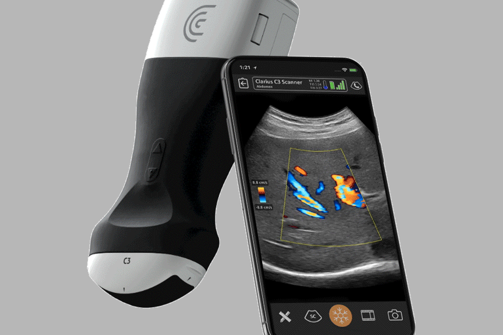 Médicos usam ultrassom portátil para acelerar diagnóstico de covid-19