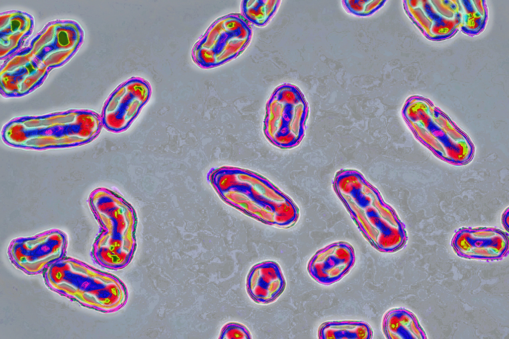 Foto de microscópio mostrando a bactéria Yersinia pestis.