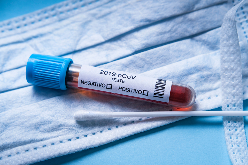 O que é a testagem em “pool”, estratégia para agilizar o diagnóstico de Covid-19