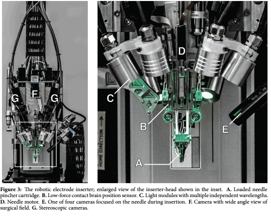 Robô Neuralink