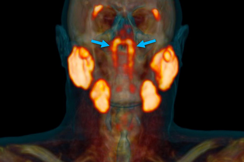 Pesquisadores podem ter encontrado duas novas glândulas no crânio humano