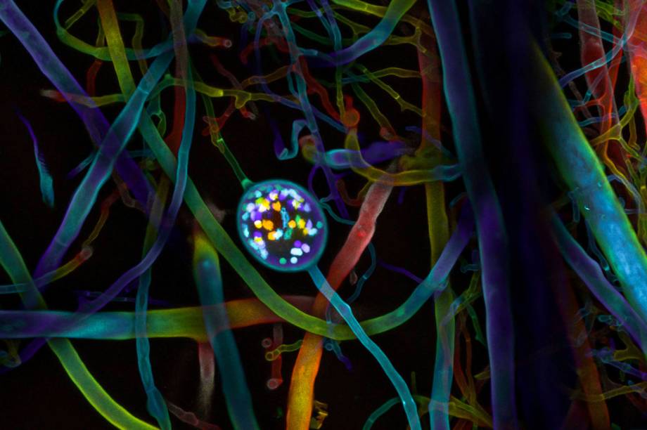 4º lugar: Poros e hifas de um fungo arbuscular, que ataca as raízes de plantas. 4º lugar: Poros e hifas de um fungo arbuscular, que ataca as raízes de plantas.